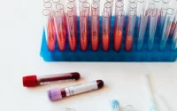 All You Need to Know About Blood Tests